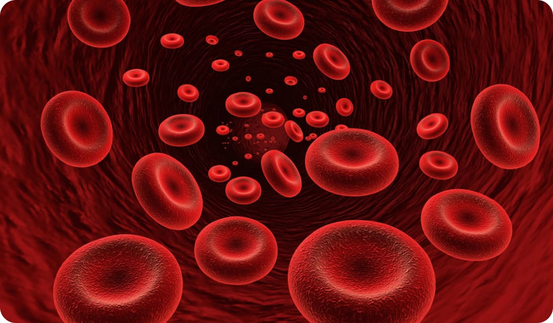 Что такое анемия? Болезнь?